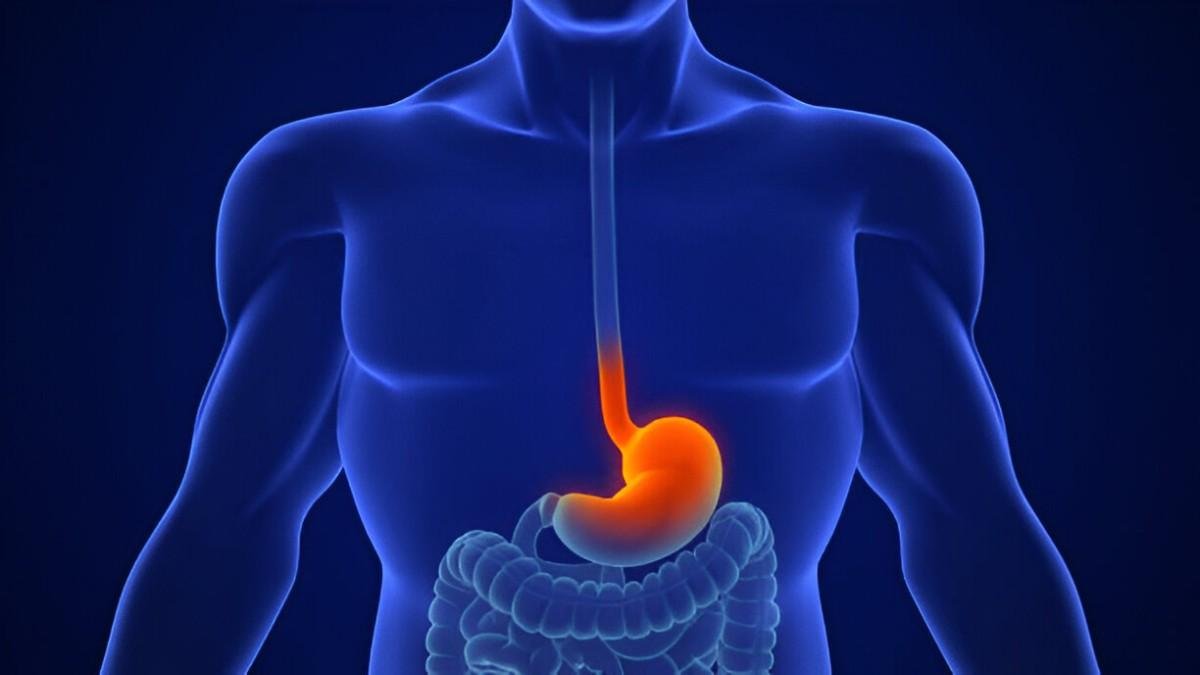 Acid Reflux