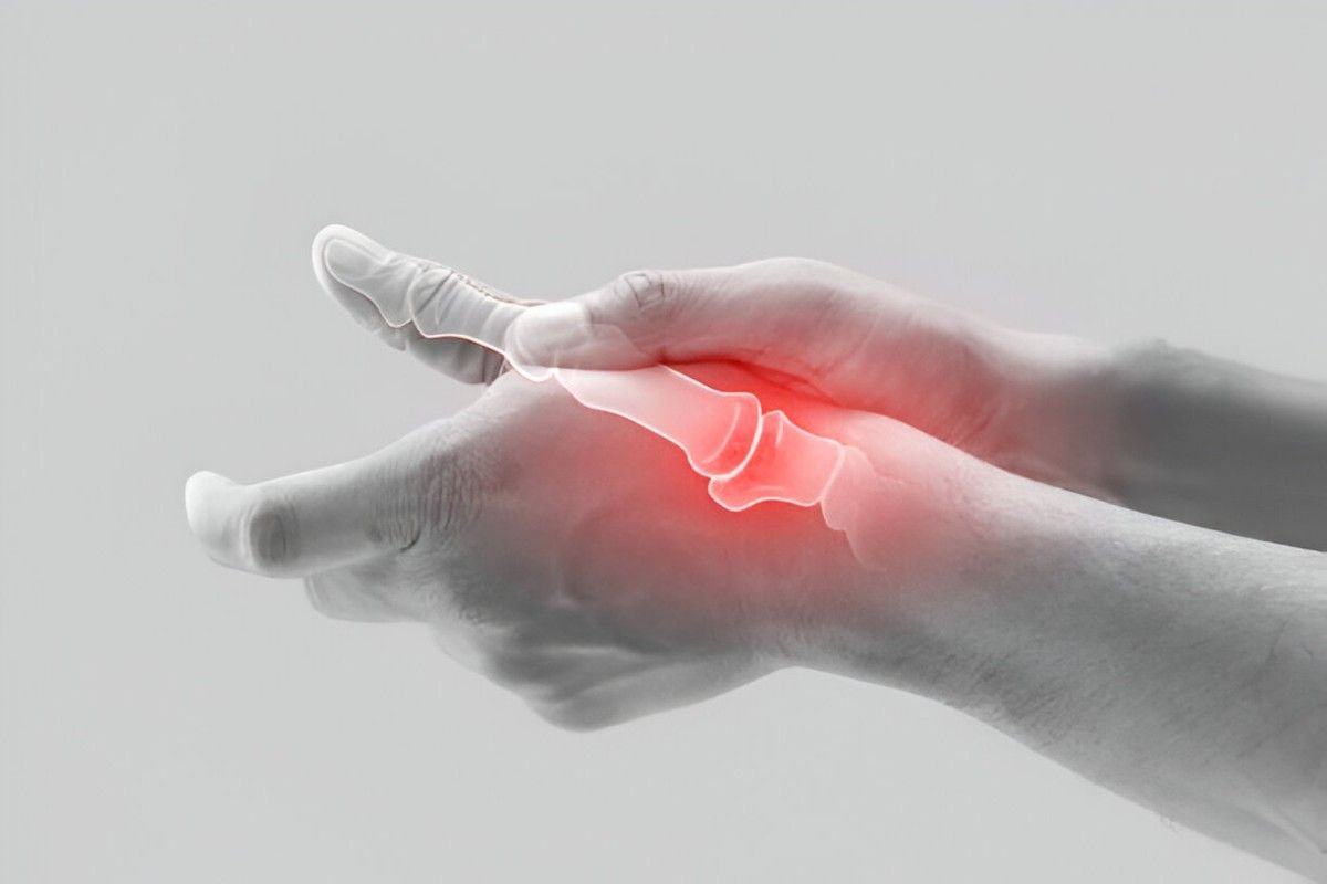 Arthritis