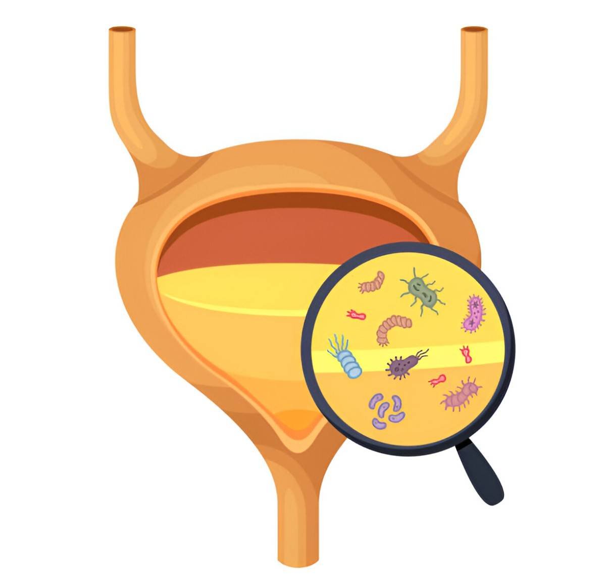 Bacterial Infections