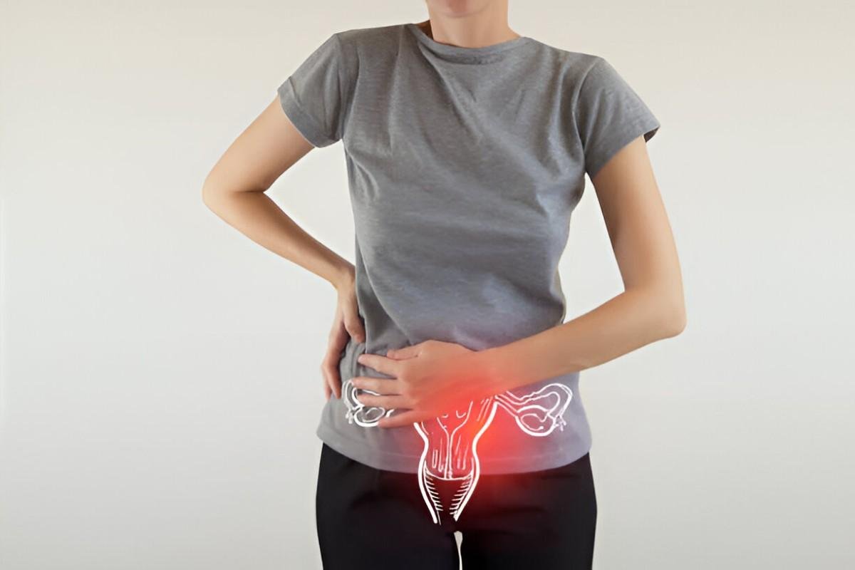 Bladder Infection