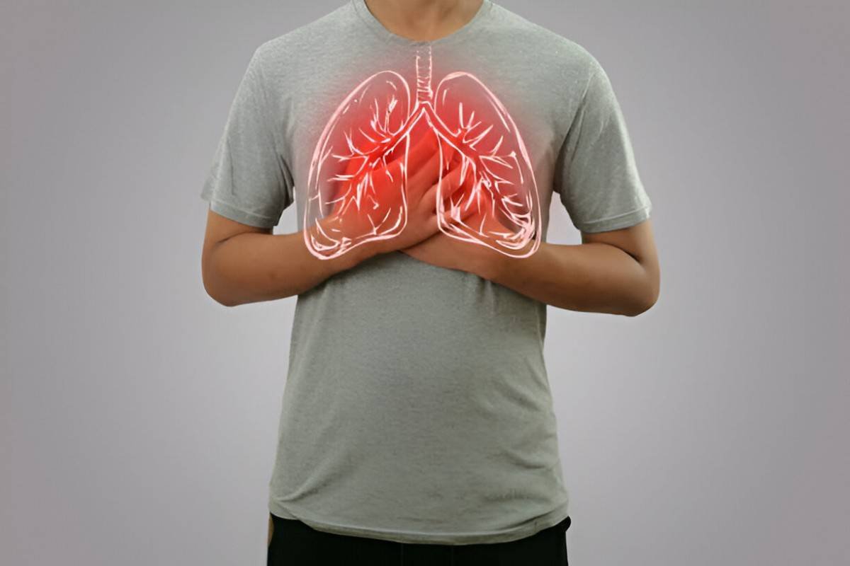 Bronchitis