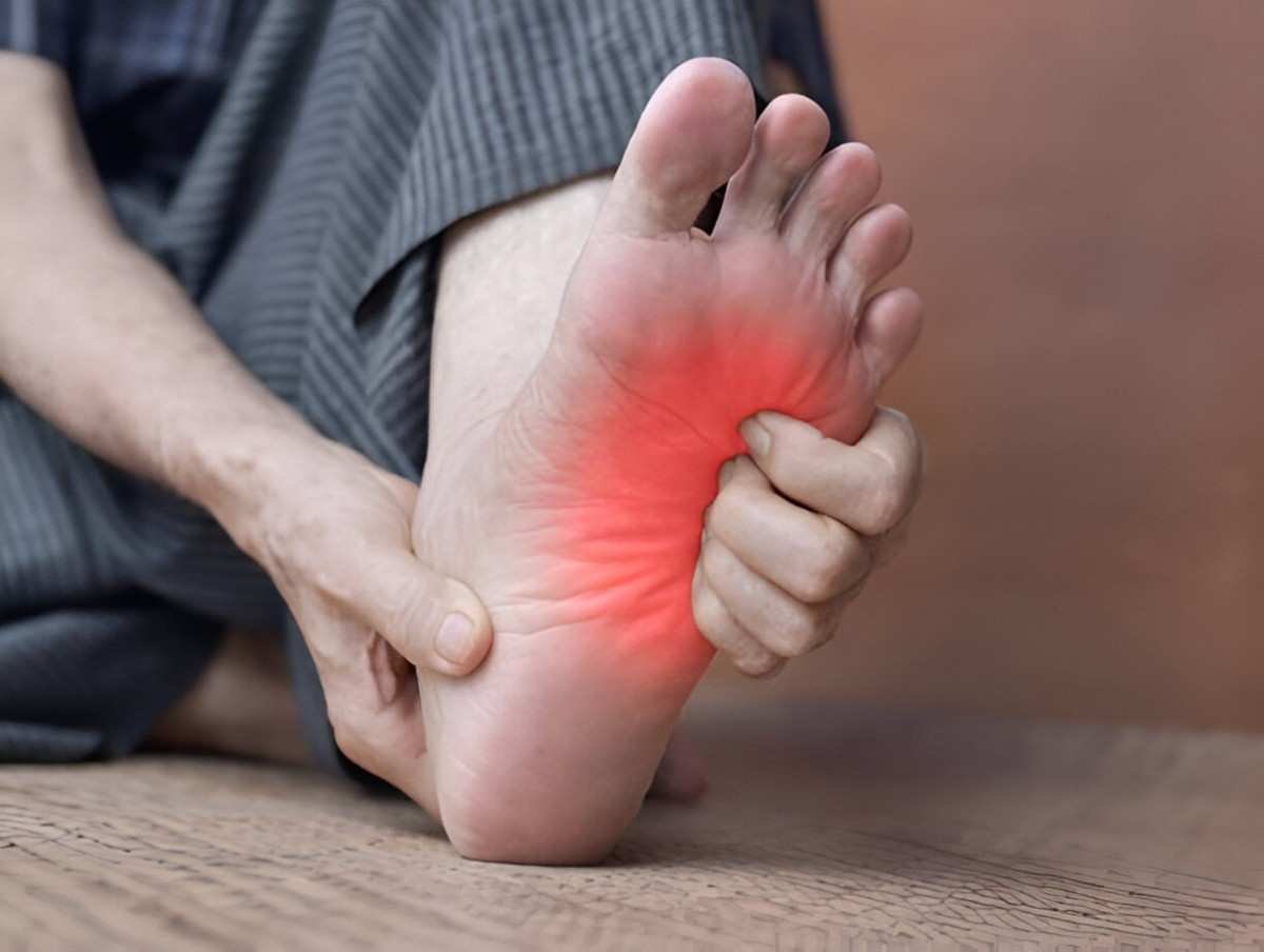 Burning Feet
