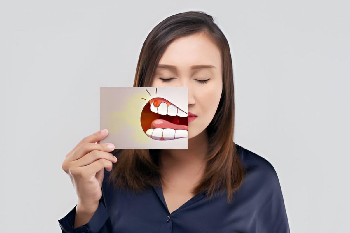 Gum Abscess