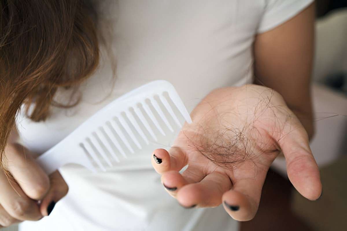 Hair Loss