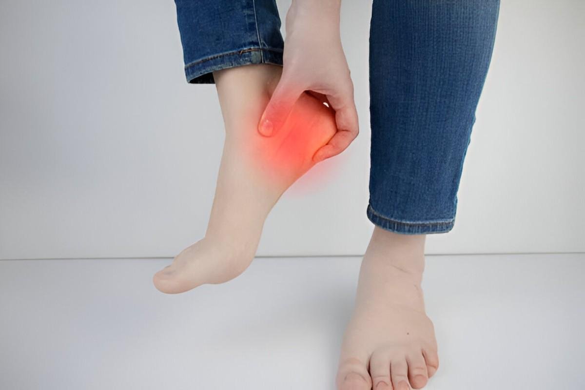 Heel Spurs
