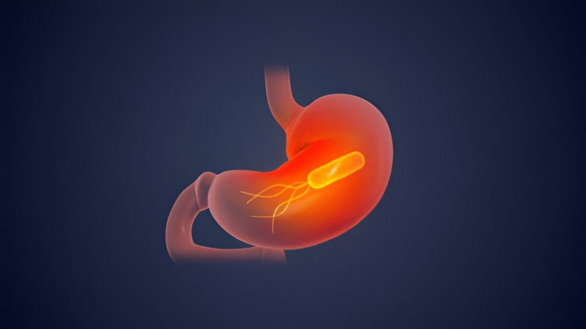 Helicobacter pylori