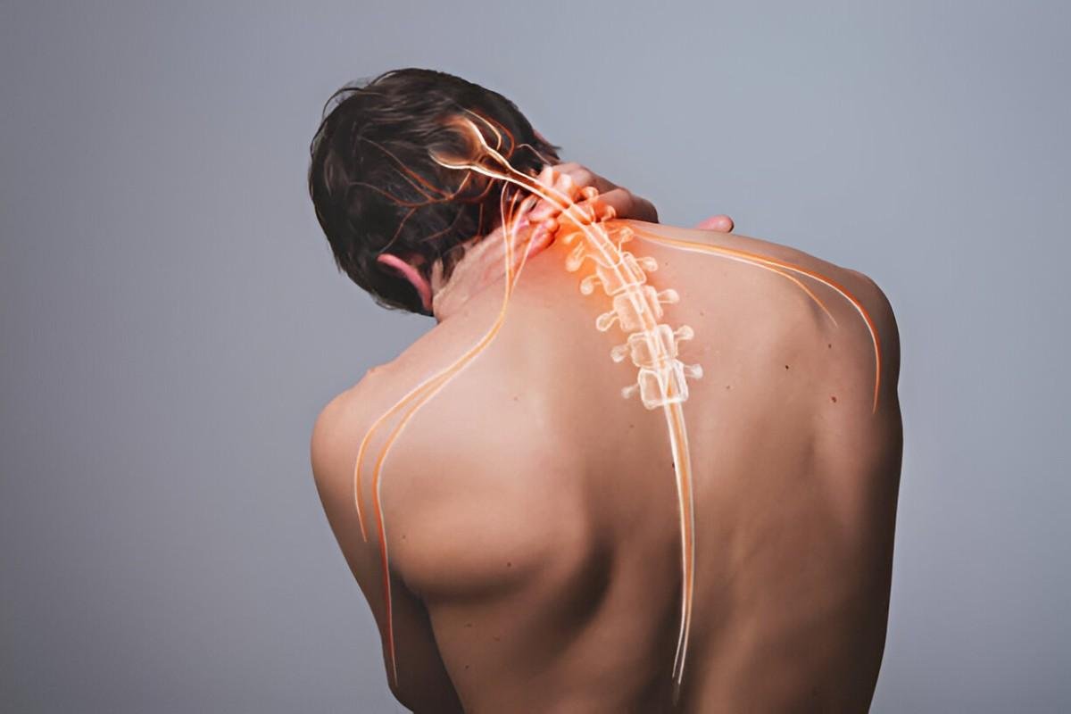 Home Remedies for Pinched Nerve Natural Ways to Relieve Discomfort