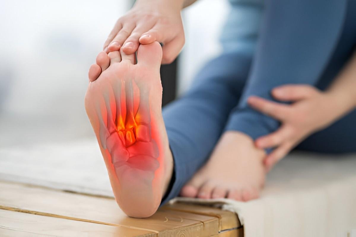 Home Remedies for Plantar Fasciitis