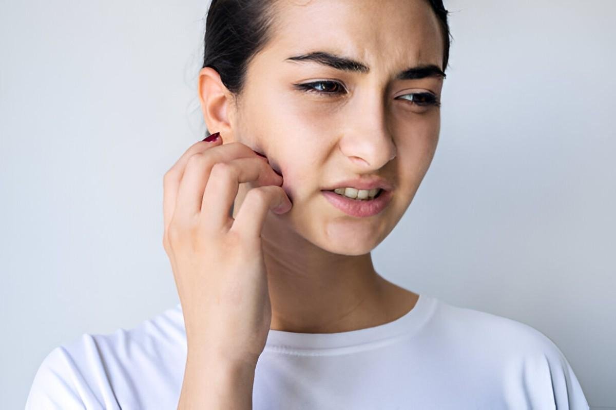 Itching on Face