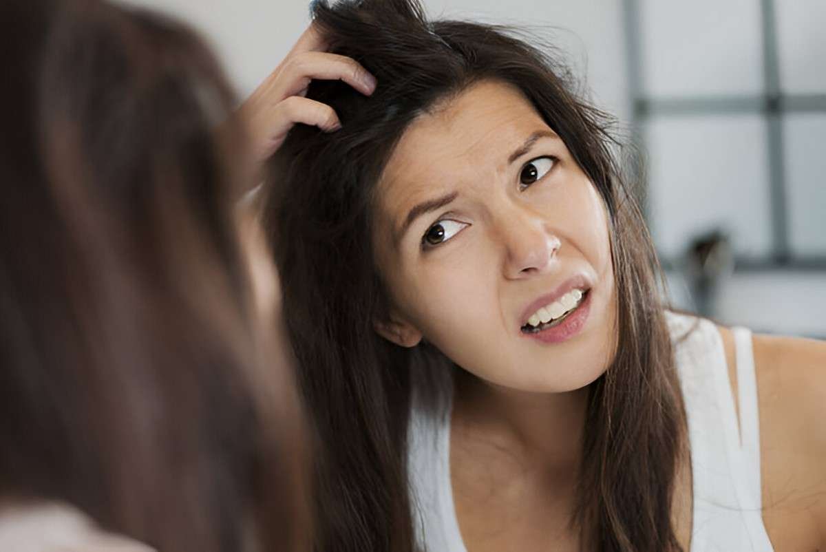 Itchy Scalp (2)