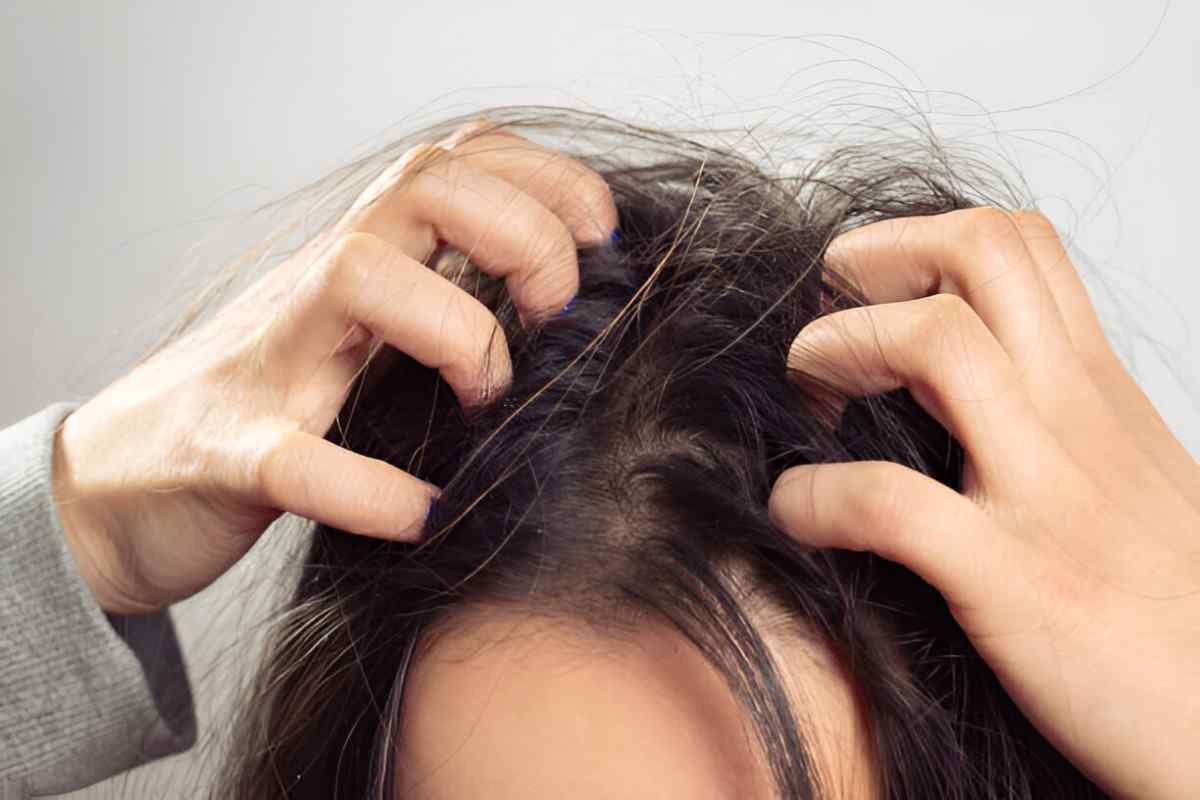 Itchy Scalp