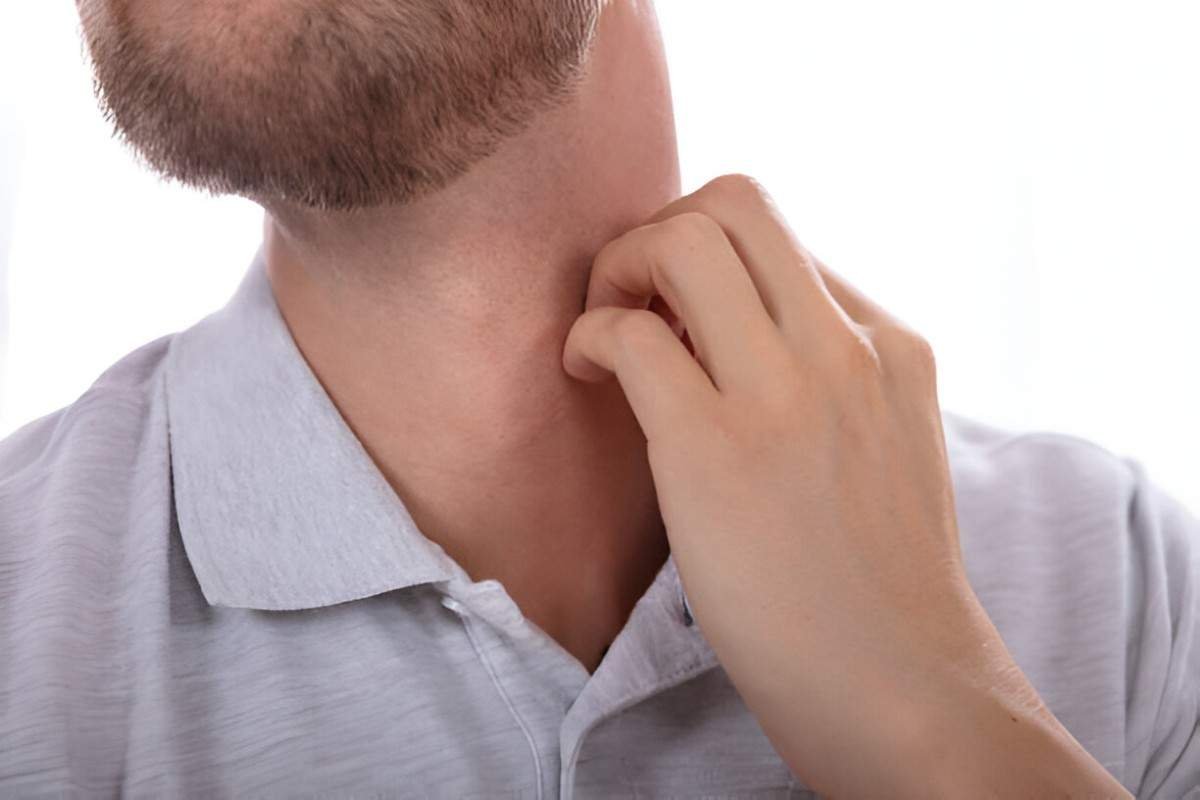 Itchy Throat