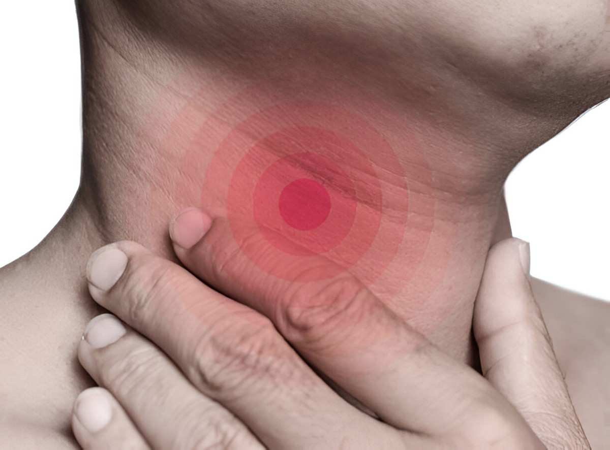 Laryngitis