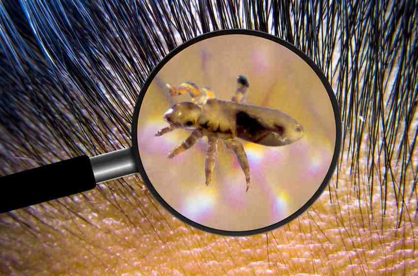 Lice
