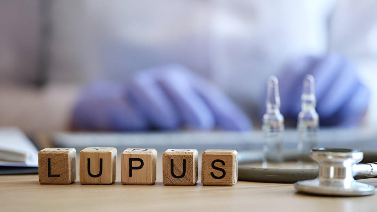 Lupus