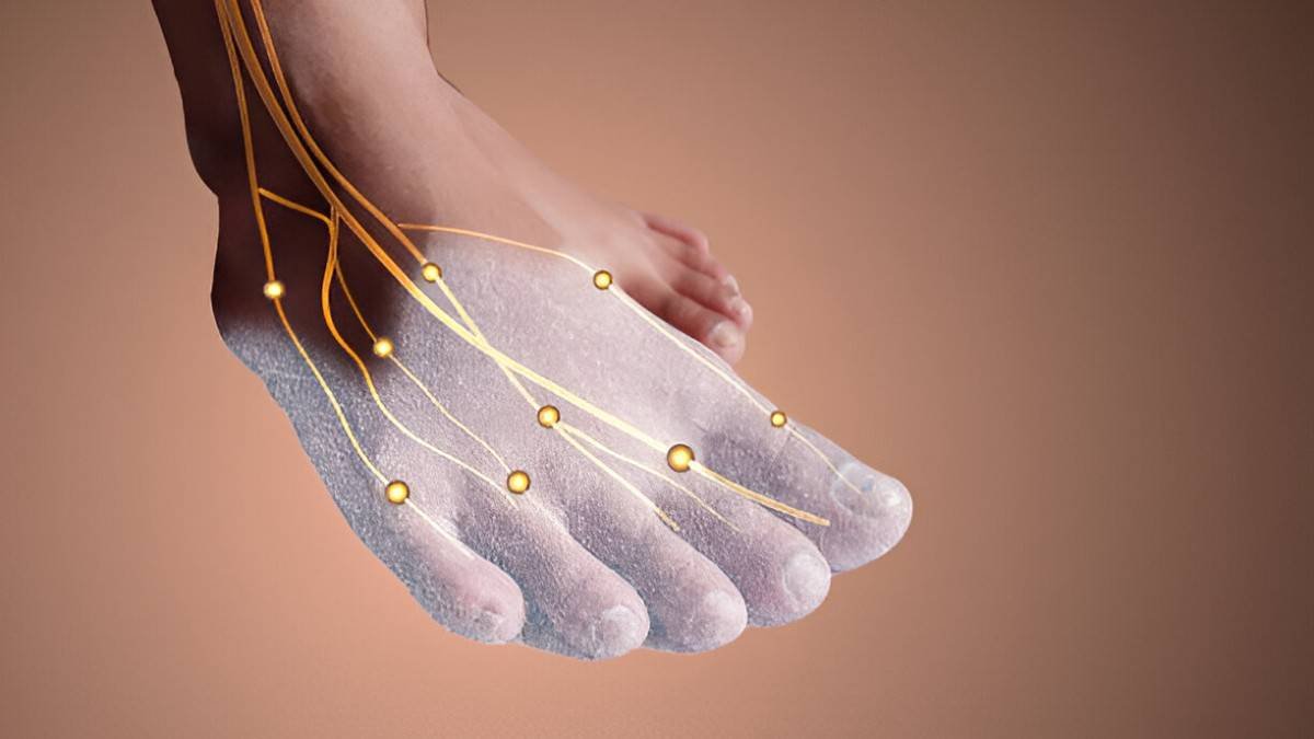 Neuropathy