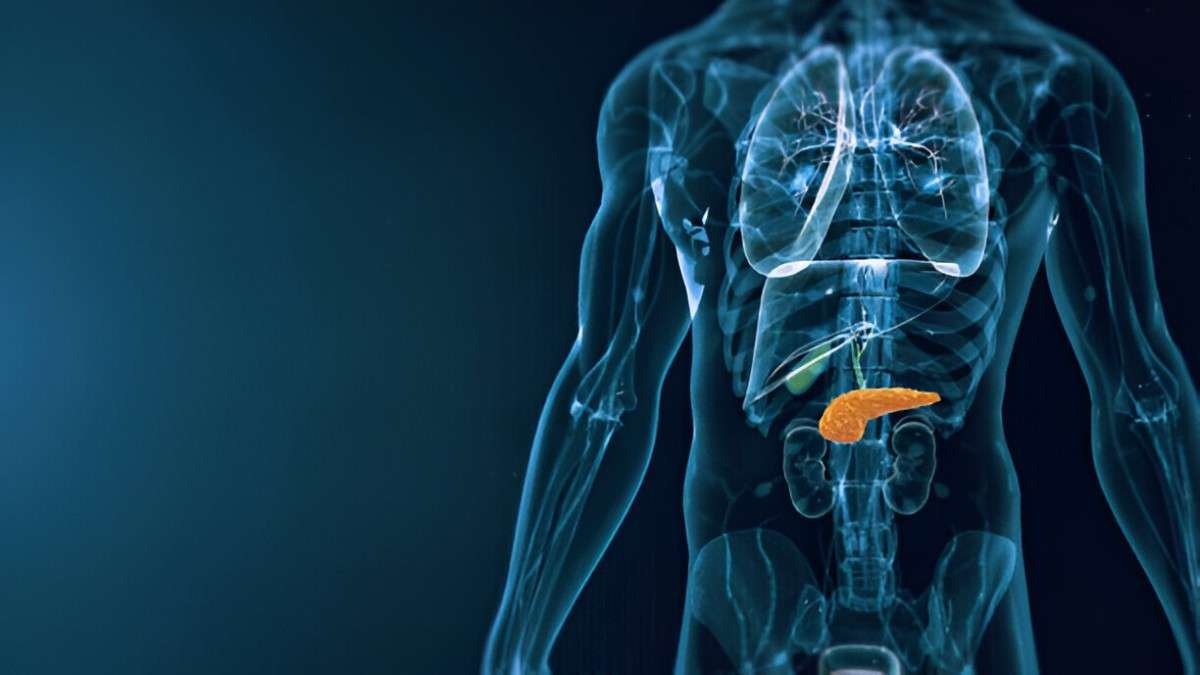 Pancreatitis