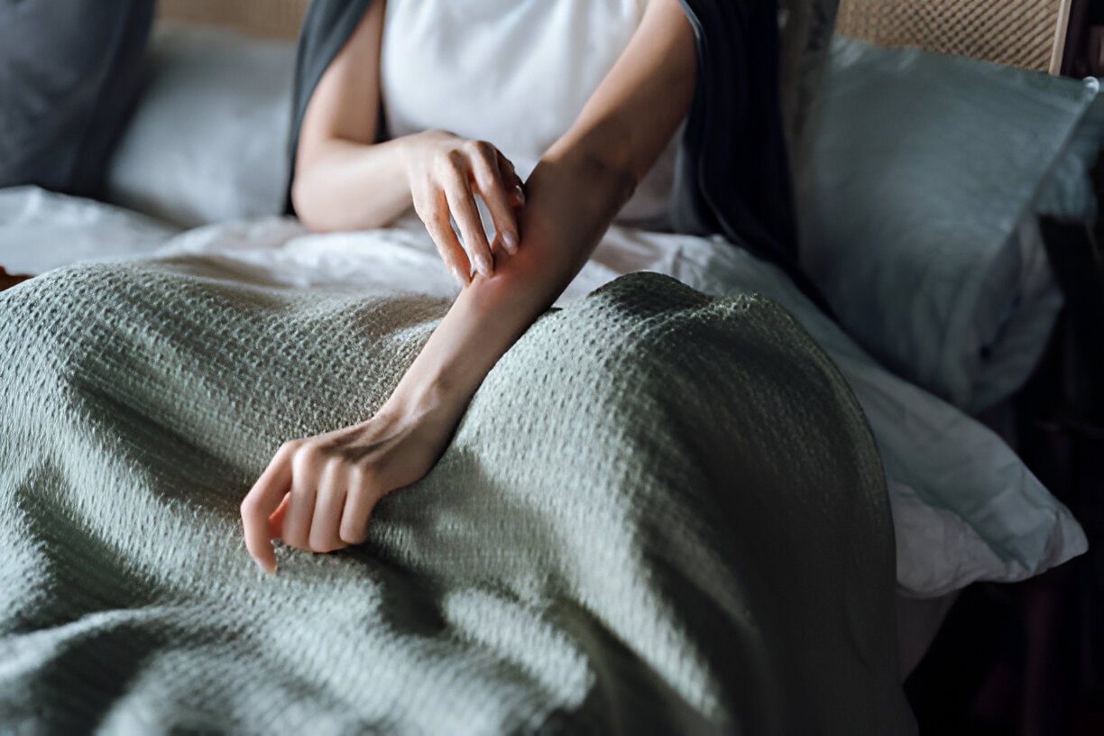 Psoriasis