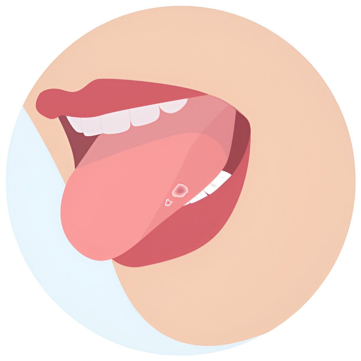 Soothe a Sore Tongue