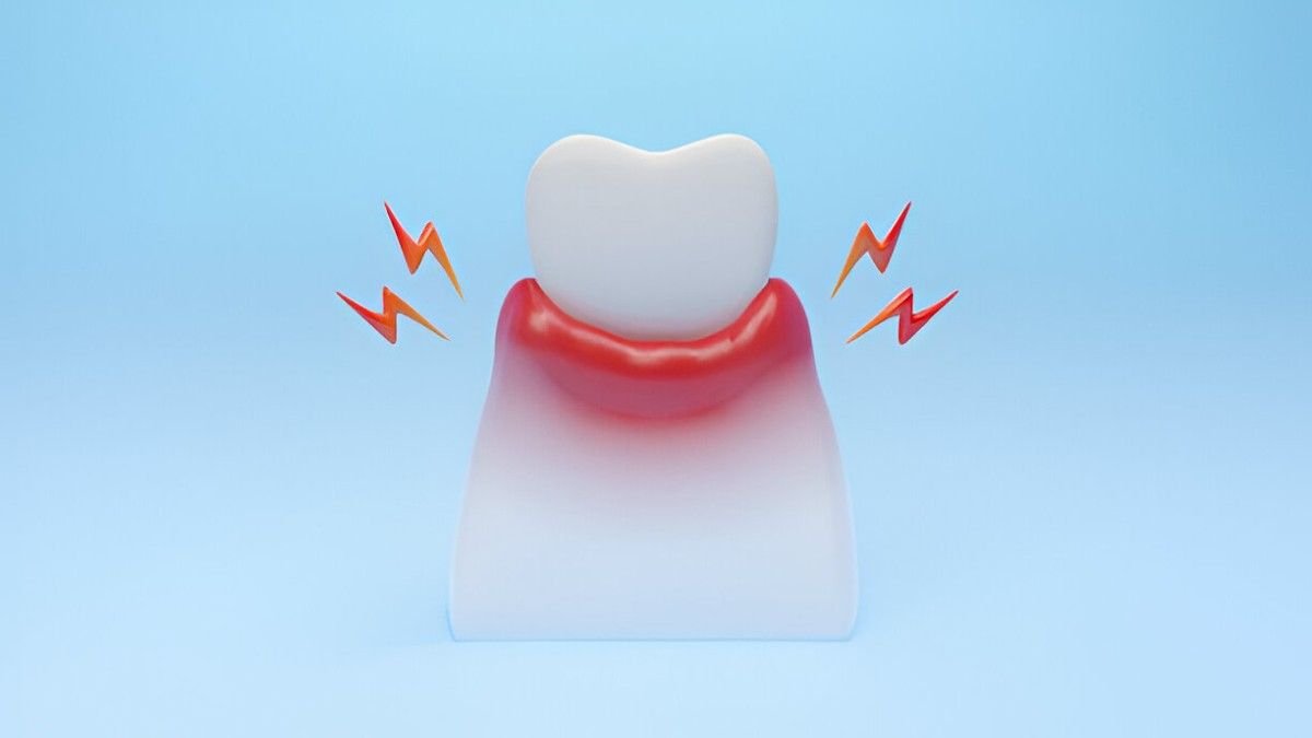 Soothing Inflamed Gums