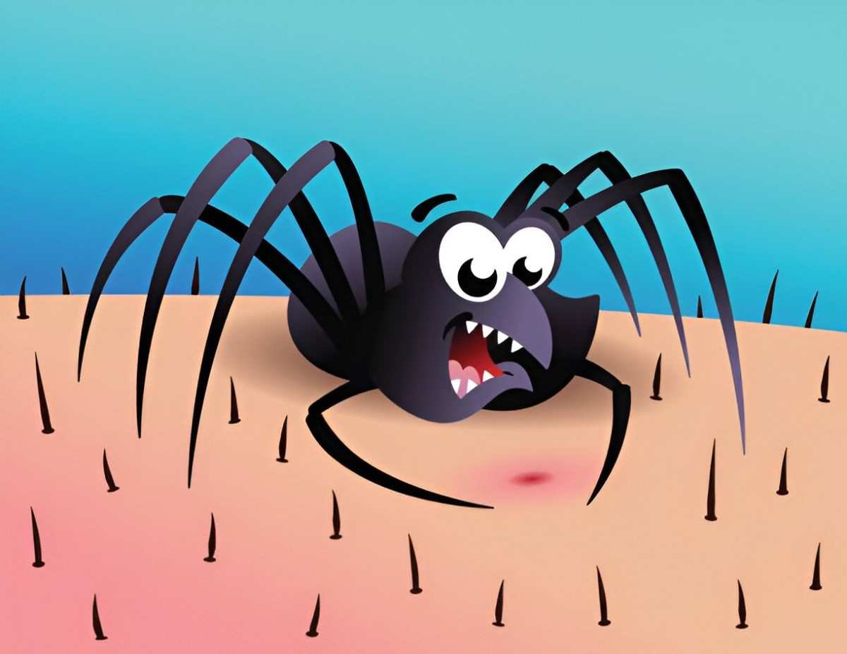 Spider Bites