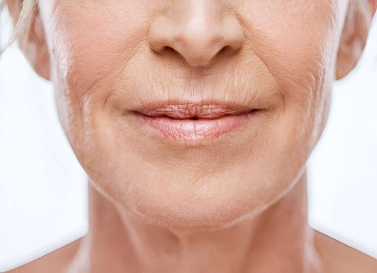 Wrinkles