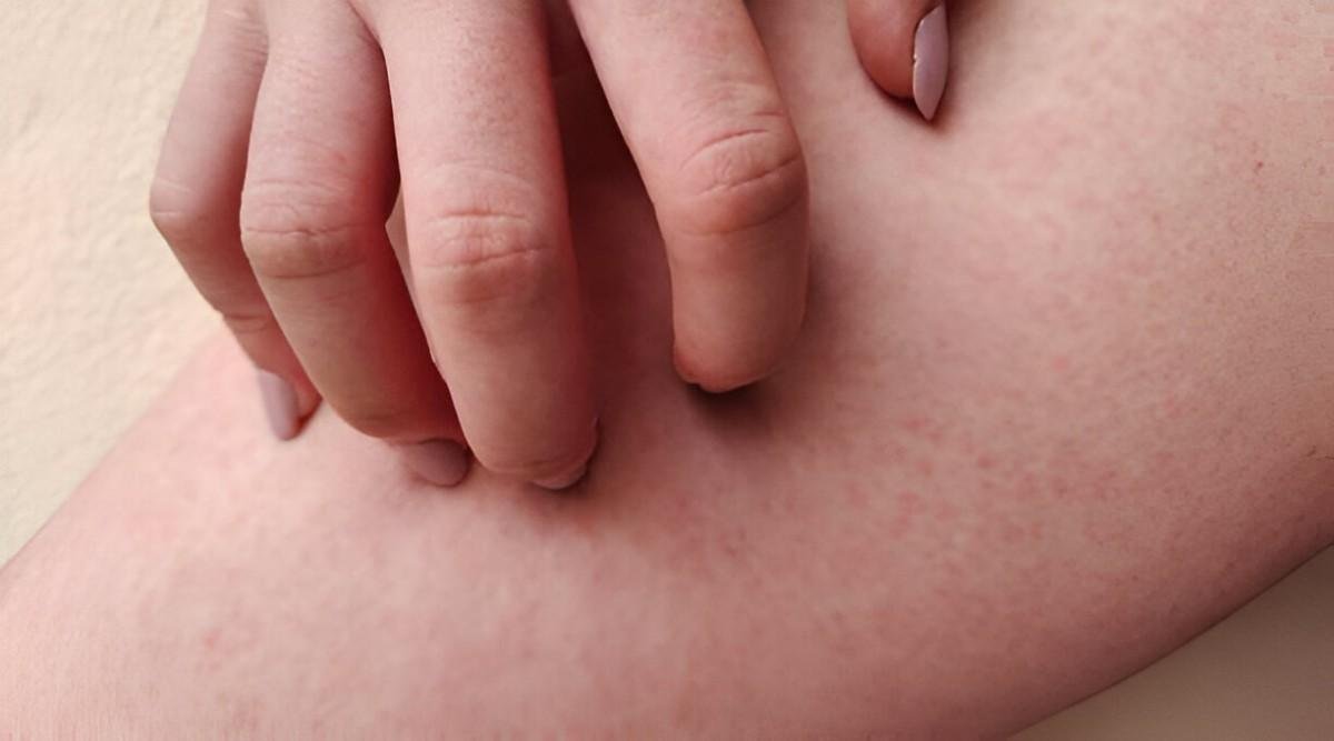 minor skin irritations